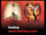 La segunda imagen más impactante fue esta de dos pulmones, uno sano y otro de un fumador, con el lema "Fumar provoca cáncer mortal de pulmón".