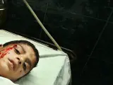 Este es el cuerpo de un joven palestino muerto en el hospital al-Shifa, tras un ataque aéreo israelí en Gaza. Un cohete ha impactado en el Ministerio del Interior de Hamas .