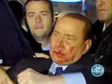Este aspecto presentaba el exprimer ministro italiano cuando fue agredido por un joven con una estatuilla tras un mitin en la plaza del Duomo (Milan), el 13 de diciembre de 2009.