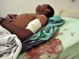 Un soldado herido yace en una cama de un hospital de Saná, en el Yemen, después del atentado suicida.