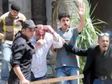 Seguidores islamistas pedían este sábado que pare la represión en todo Egipto contra los seguidores del depuesto presidente Morsi. En la imagen, uno de los heridos en los enfrentamientos en la mezquita al-Fateh.