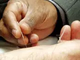 La acupuntura es una técnica originaria de China.
