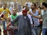 Un simpatizante de Morsi es conducido por varios manifestantes anti-Morsi durante los disturbios que se han producido en El Cairo, Egipto.