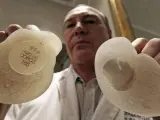 Un cirujano plástico francés muestra los implantes de silicona fabricado por Poly Implant Prothese (PIP).