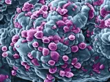 Células de un cáncer de mama atacadas por un medicamento químico descargado por nanotransportadores