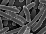 Escherichia coli, una de las muchas especies de bacterias presentes en el intestino humano.