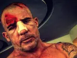 El actor Dominic Purcell con heridas en la cara tras sufrir un accidente durante el rodaje de 'Prison Break'.