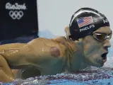 El nadador estadounidense Michael Phelps compitiendo en los Juegos de Río. En su hombro derecho se aprecian las marcas de círculos rojos.