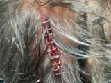 Uno de los policías heridos con una brecha en la cabeza en el CIE de Murcia
