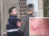 Momento de la agresión al 'youtuber' Granbomba, junto a la herida de su cara.