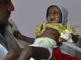 Un doctor sujeta a un niño malnutrido en un centro de alimentación de Saná, en Yemen.