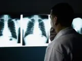 Un médico observa dos radiografías de pulmones, en una imagen de archivo.