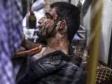 Un hombre herido en los ataques aéreos y de artillería perpetrados contra distintas zonas de la región de Guta Oriental en los que al menos 22 personas murieron y otras 67 resultaron heridas, recibe tratamiento médico en Duma (Siria).