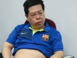 El miembro del Partido Demócrata chino Howard Lam muestra las heridas de sus piernas durante una rueda de prensa.