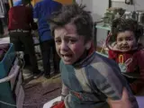 Niños heridos reciben ayuda en un hospital controlado por los rebeldes en Douma (Siria).