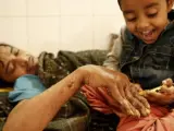 Abul Bajandar juega con su hija, Jannatul Ferdous Tahira, en una habitación de la unidad de quemados del hospital, en Daca, Bangladés.