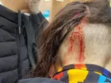 Un manifestante, herido en Drassanes.