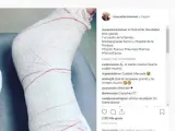 Instagram de la alcaldesa de Madrid, Manuela Carmena, tras caerse en su casa y romperse un tobillo.