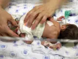 Un bebé prematuro recibe cuidados en una incubadora.