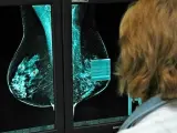 Una investigadora del cáncer de mama, en una imagen de archivo.