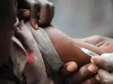 Un niño recibe una vacuna contra el sarampión en un campamento de desplazados de la República Democrática del Congo, en una imagen de archivo.