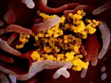 Imagen al microscopio electrónico de partículas del coronavirus 2019-nCoV/SARS-CoV-2/virus de COVID-19 (amarillo) emergiendo de una célula en cultivo (rosa).