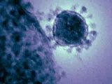 Imagen de archivo de un coronavirus
