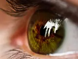 El glaucoma se detecta fácilemene a través de pruebas oftalmológicas que comprueban la salud del nervio óptico.