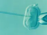 Imagen de un tratamiento de fecundación in vitro