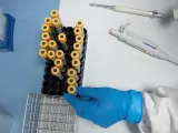 Una medico manipula muestras para hacer un análisis de serología de COVID-19.