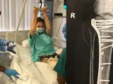 Ashley Judd, en el hospital, tras ser operada y una radiografía de los tornillos instalados en su pierna para mantenerla unida.