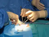 El Hospital de La Candelaria pone en marcha un nuevo circuito sin hospitalización para la cirugía de tiroides