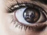 La aniridia es la ausencia total o parcial del iris del ojo.