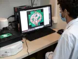 La investigadora examina una imagen microsc&oacute;pica de un tubo de un vaso sangu&iacute;neo rodeado de tejidos cancerosos.