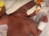 Curtis Means, el bebé prematuro más pequeño del mundo