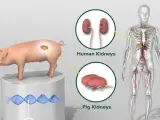 Apenas una semana después de haber sido testigos del primer trasplante de corazón de un cerdo a un humano, un equipo de investigadores estadounidenses ha logrado trasplantar con éxito dos riñones de cerdo modificados genéticamente a un hombre que se encontraba en muerte cerebral.