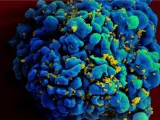 Un nuevo estudio habla sobre la nueva variante del VIH: más virulenta y agresiva