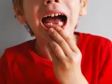 Imagen de archivo de un niño al que se le han caído los dientes.