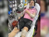 Pipi Estrada, tras el accidente de moto.