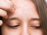 La piel seca tiene tendencia a la irritación y descamación