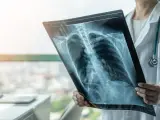 Un médico observa la imagen del pulmón de un paciente.