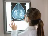 Doctora mirando una radiografía