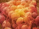 Científicos han descubierto la relación existente entre una dieta alta en grasas, ciertos microbios intestinales y el crecimiento de tumores de cáncer de mama.