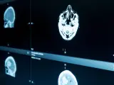 Escáner de un cerebro, en una imagen de archivo.