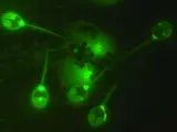 El núcleo de cada espora de 'Henneguya salminicola' brilla en verde bajo un microscopio fluorescente.