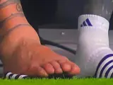 Torcedura de tobillo de Leo Messi.